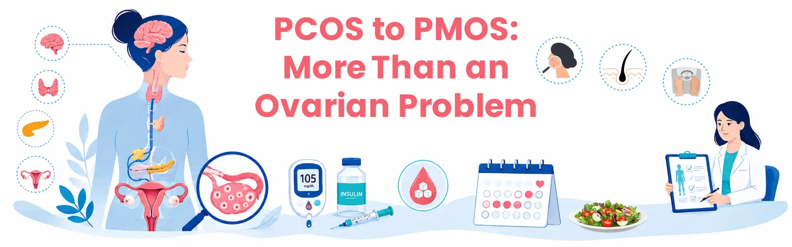 PCOS to PMOS: More Than an Ovarian Problem