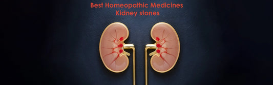 Best Homeopathic medicines for Kidney stones
