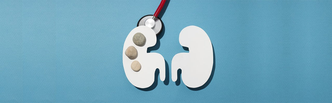 Homeopathic treatment for kidney stones